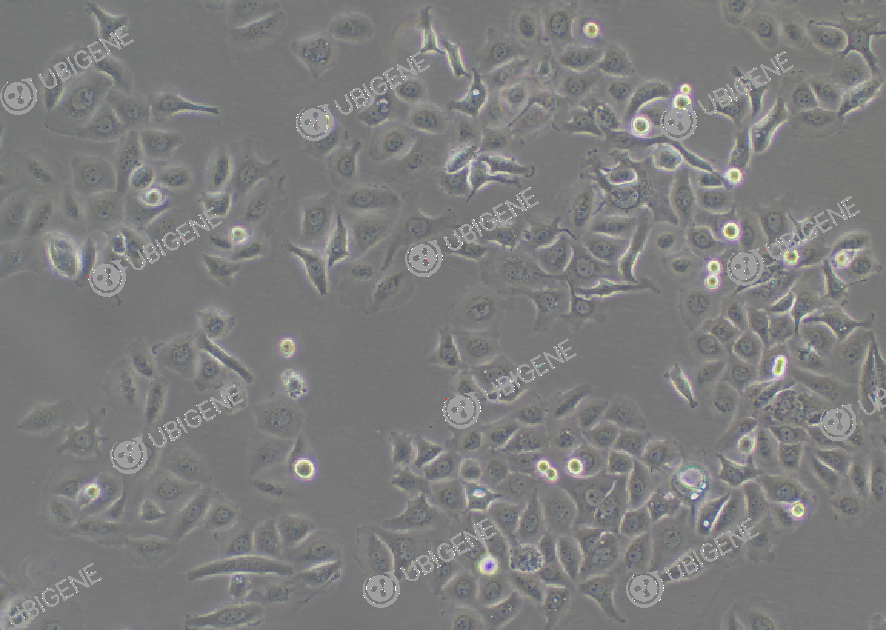 HCC1143 cell line Cultured cell morphology
