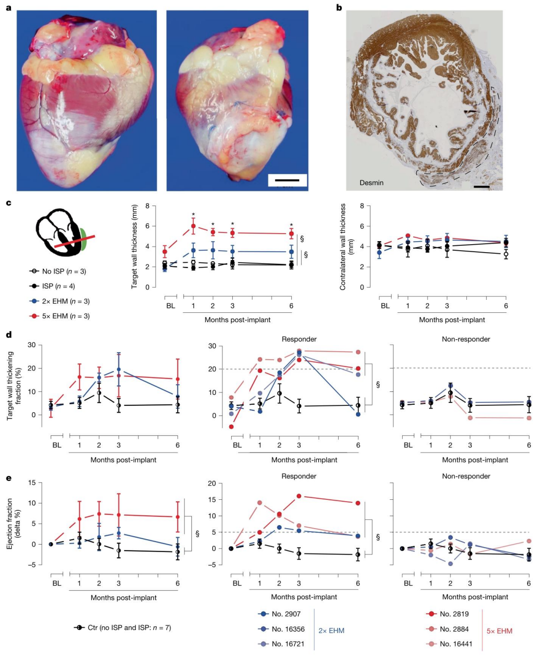 Figure 3. EHM Allografts Promote Local and Global Cardiac Functional Recovery via Myocardial Regeneration in a Chronic Heart Failure Model