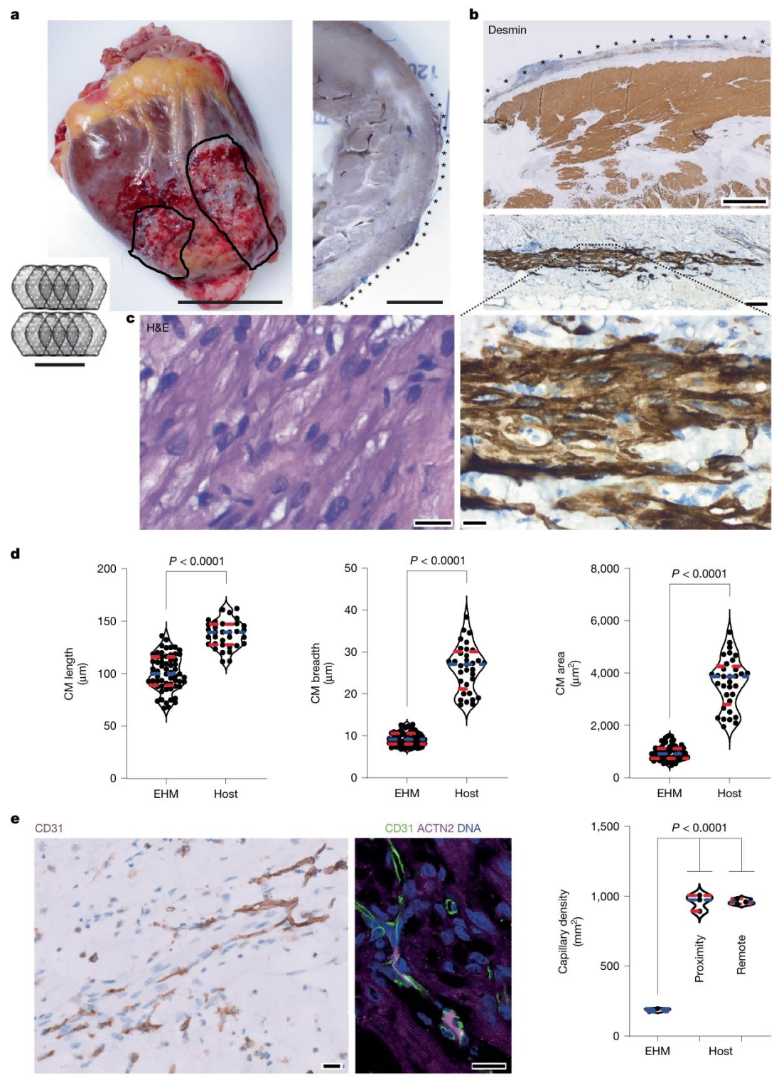 Figure 5. Myocardial Regeneration in the Human Heart