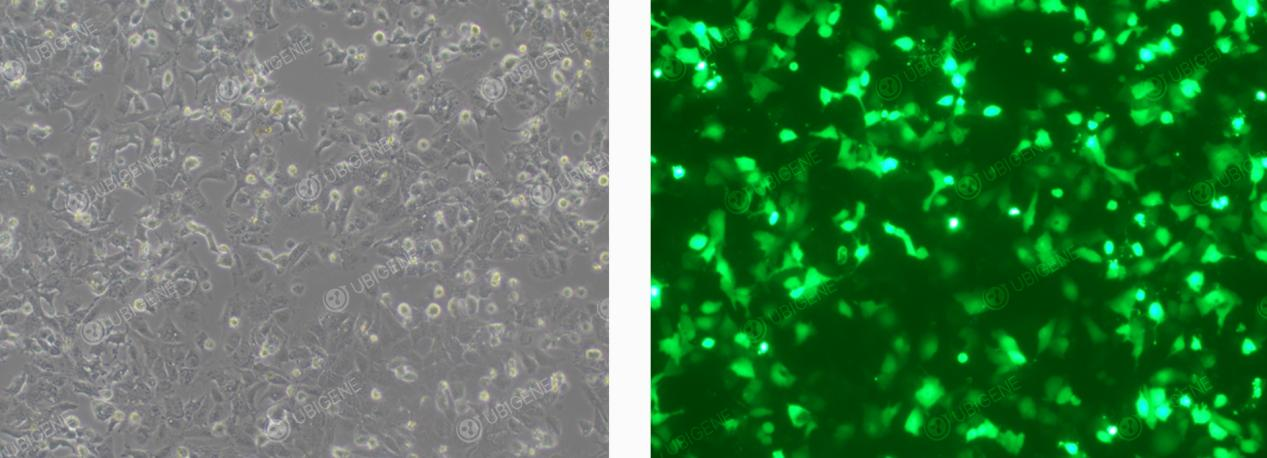 Cells Following Electroporation Transfection