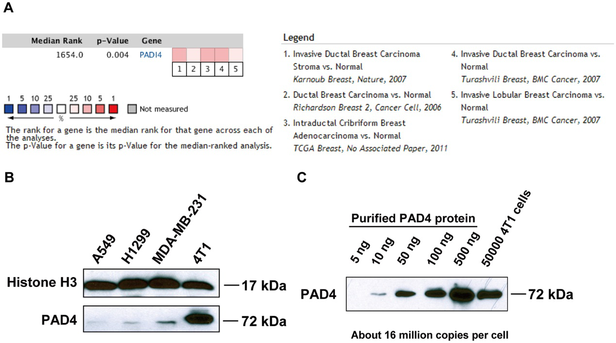  PAD4 expression in human and mouse mammary tumors.