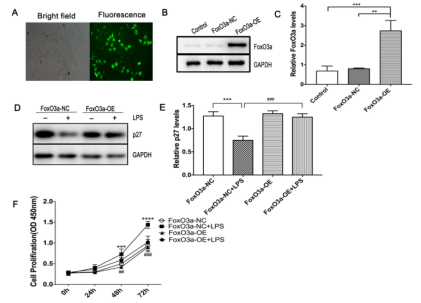 Overexpression of FOXO3a in PI3K/AKT signaling pathway can increase the expression of p27