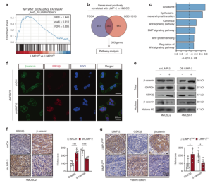 LIMP-2 exerts oncogenic effects by activating the GSK3β/β-catenin pathway