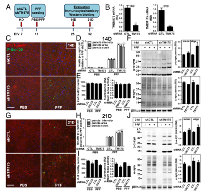 Knockdown of TMEM175 led to an increased propensity for accumulation of α-synuclein aggregates in rat hippocampal neuronal cell line