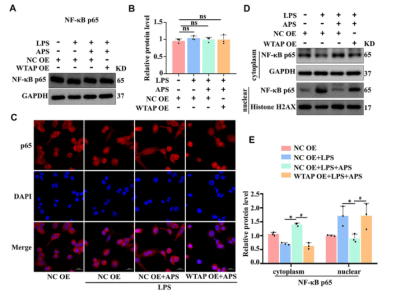 APS regulates IL-6 expression through WTAP-mediated p65 nuclear translocation
