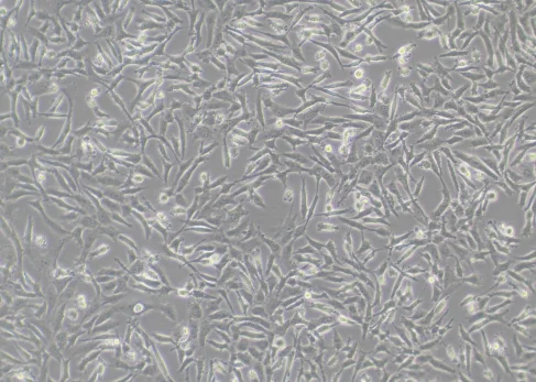 Lentivirus Infection of MDA-MB-231 Cells