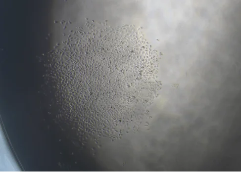 Monoclone of MDA-MB-231 cell