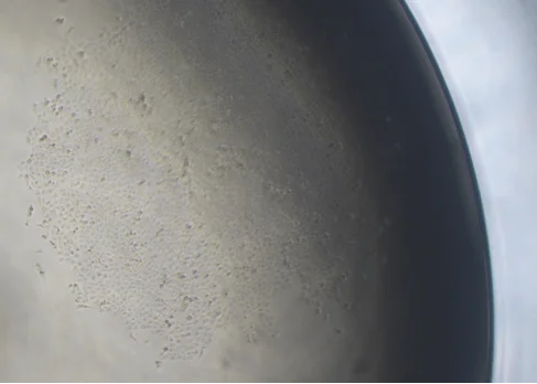 Monoclone of MDA-MB-231 cell