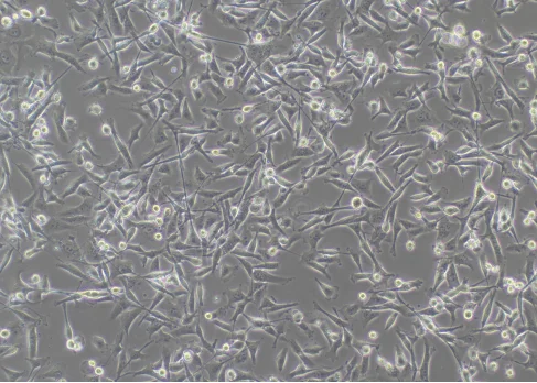 Normal MDA-MB-231 cells
