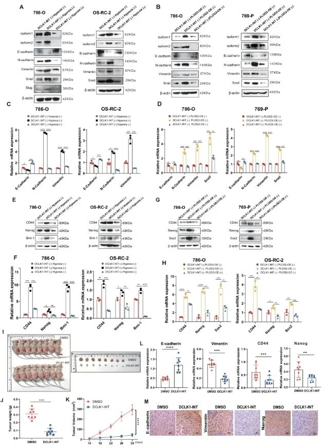 Targeting DCLK1 attenuates the malignant progression of hypoxia- and PLOD2-enriched clear cell renal cell carcinoma both in vitro and in vivo.