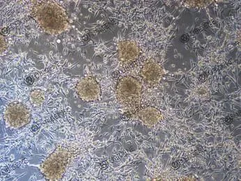 abnormal morphology mc38 cell