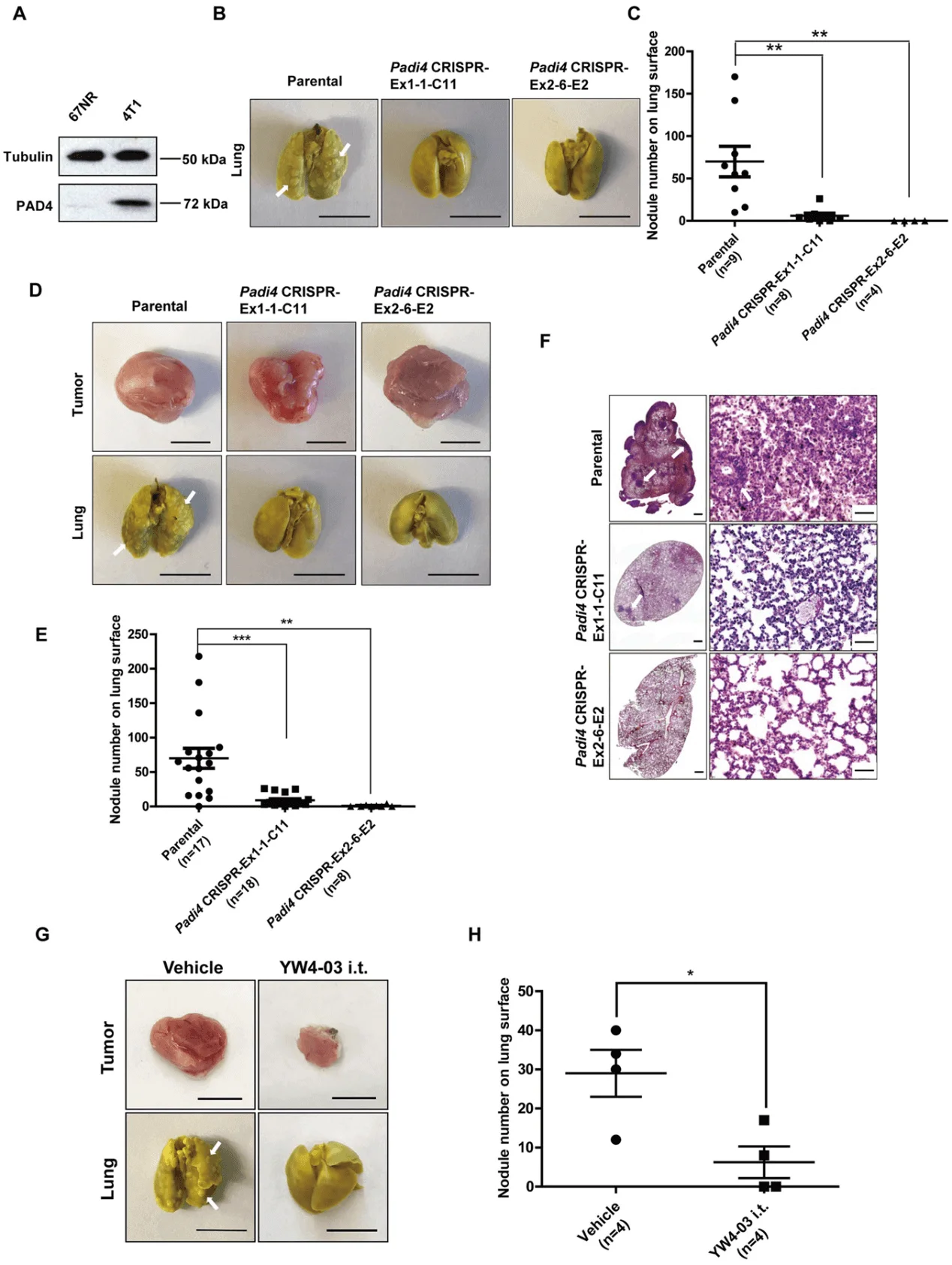 Lack of PAD4 in tumors leads to reduced lung metastasis.