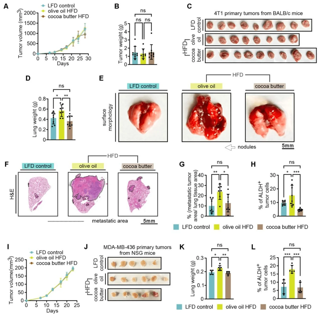 Olive oil–based high-fat diet–induced obesity promotes TNBC lung metastasis, whereas cocoa butter–based high-fat diet does not