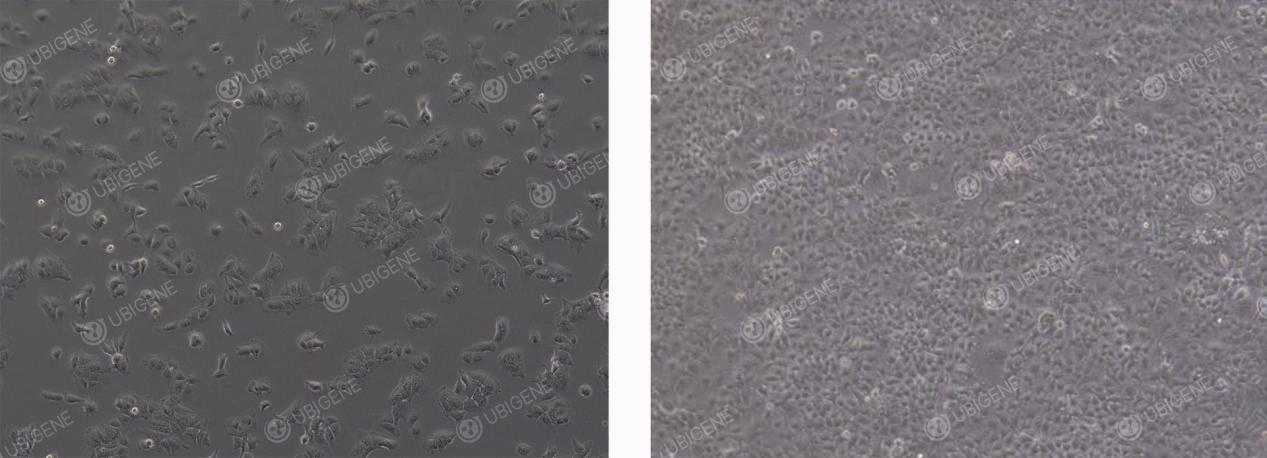 HuH-7 Normal Morphology