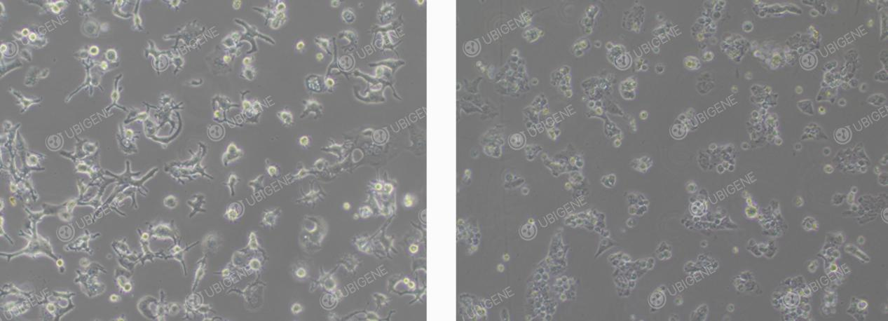 HuH-7 Abnormal Morphology
