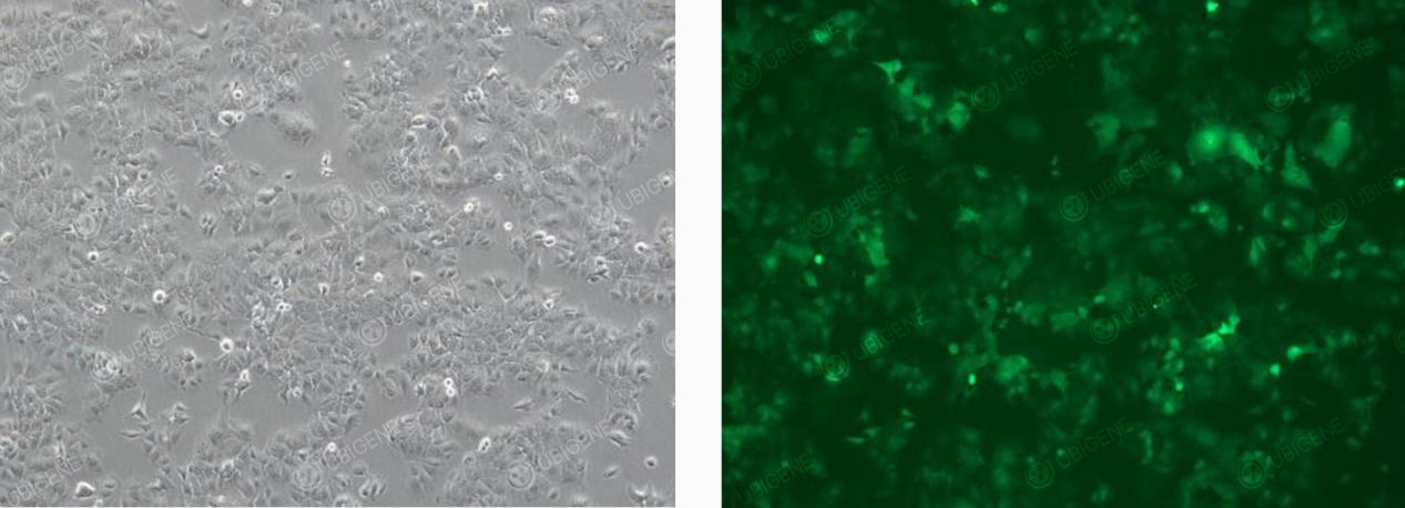 Cells Following Lentiviral Transduction