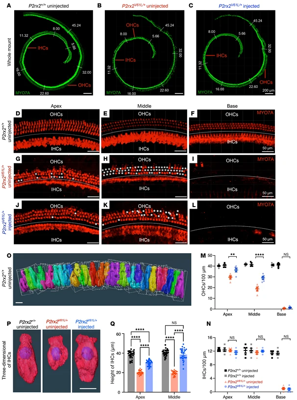 Figure 3. V2–SaCas9–sgRNA1 Adult Injection Restores Outer Hair Cell (OHC) and Inner Hair Cell (IHC) Length in the DFNA41 Mouse Model (P2rx2^V61L/+)