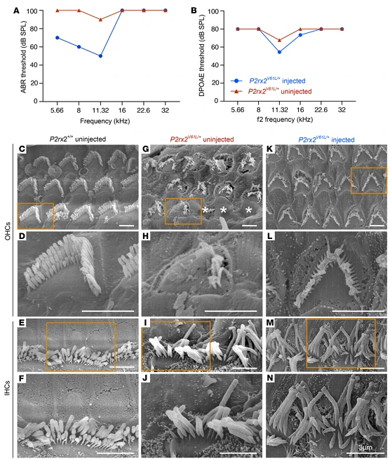 Figure 4. AAV2–SaCas9–sgRNA1 Rescues Hair Cell Morphology in the DFNA41 Mouse Model (P2rx2^V61L/+)
