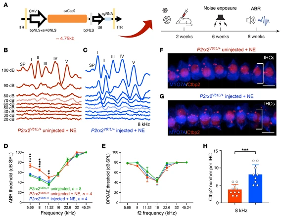 Figure 6. AAV2-SaCas9-sgRNA1 Injection Mitigates Increased Noise-Induced Hearing Loss (NIHL) Sensitivity in the DFNA41 Mouse Model (P2rx2^V61L/+)