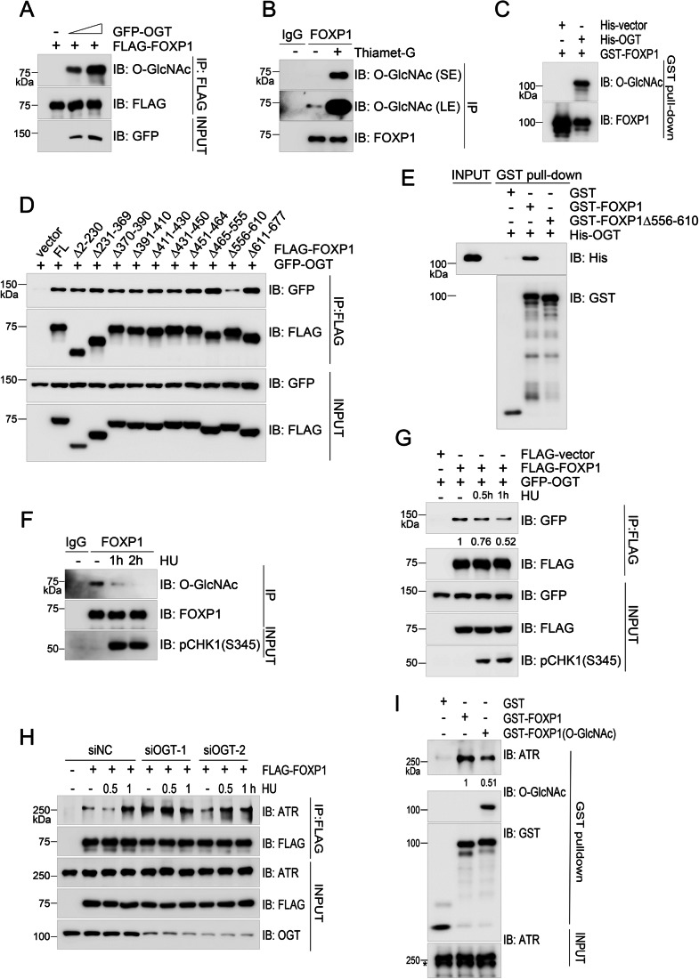 Figure 4. OGT-mediated O-GlcNAcylation of FOXP1 inhibits its interaction with ATR