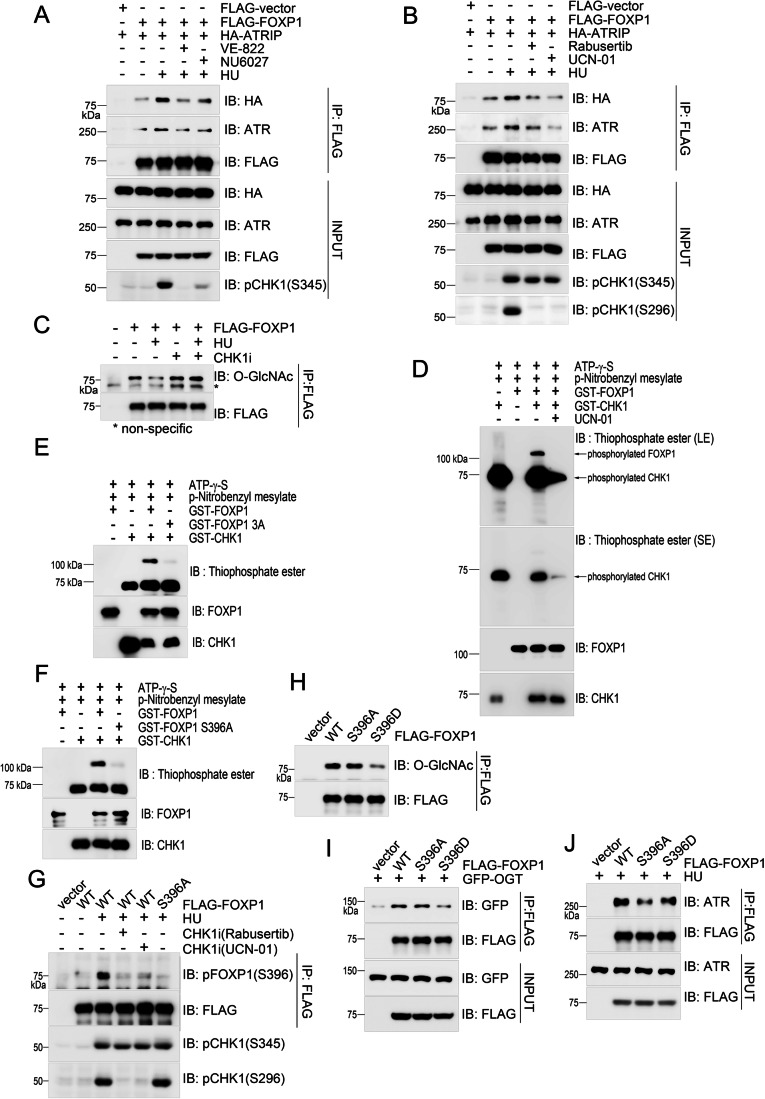 Figure 5. CHK1-mediated phosphorylation of FOXP1 at S396 antagonizes its O-GlcNAcylation