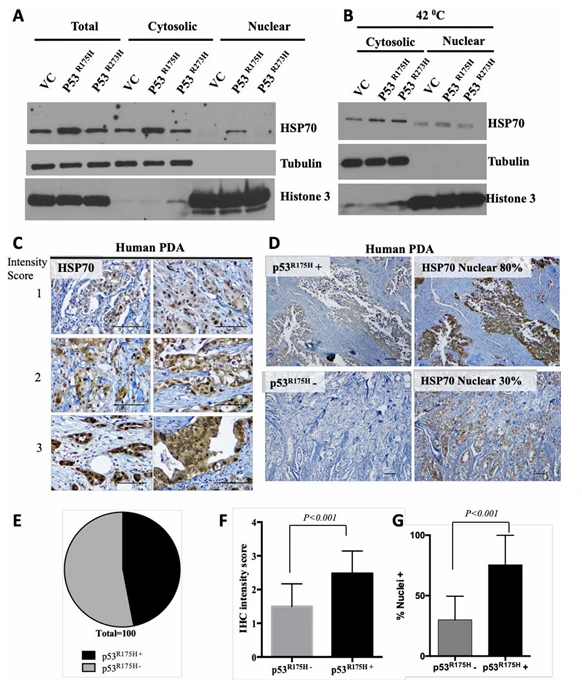 Figure 3. Mutant p53 R175H promotes nuclear accumulation and stabilization of HSP70