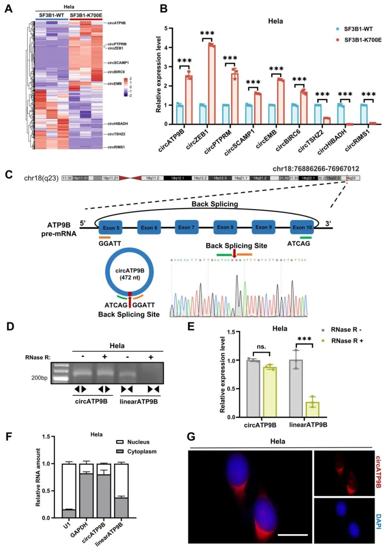 SF3B1 mutation affects circRNA expression and characterization of circATP9B