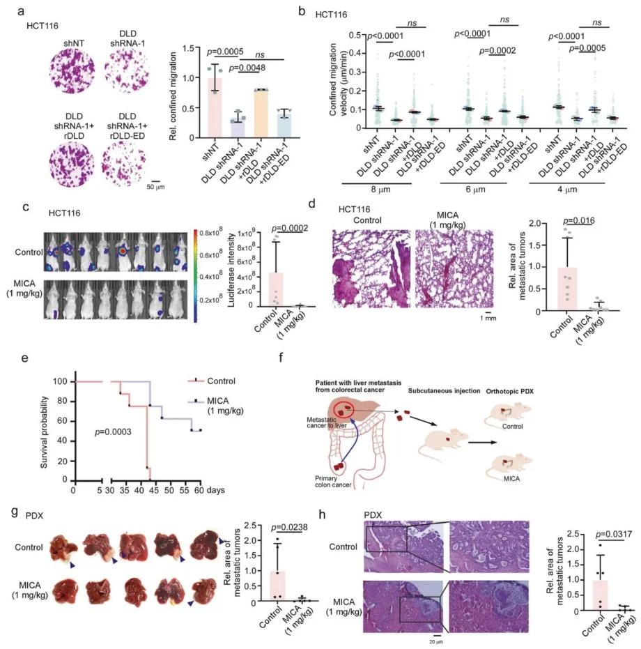 Figure 2. Pharmacological inhibition of DLD suppresses tumor metastasis.