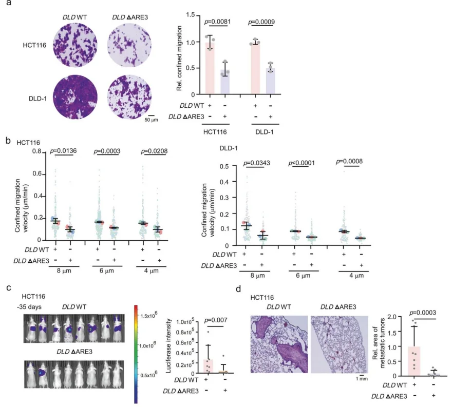 Figure 5. hnRNPA0-dependent stabilization of DLD mRNA promotes tumor cell migration through confined spaces and drives distant metastasis.