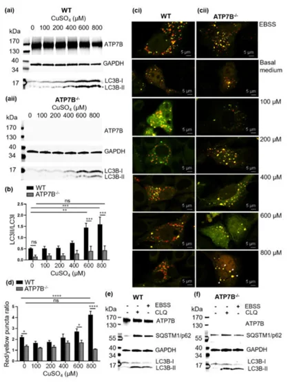 Effects of ATP7B knockout on copper-induced autophagy in HepG2 cells
