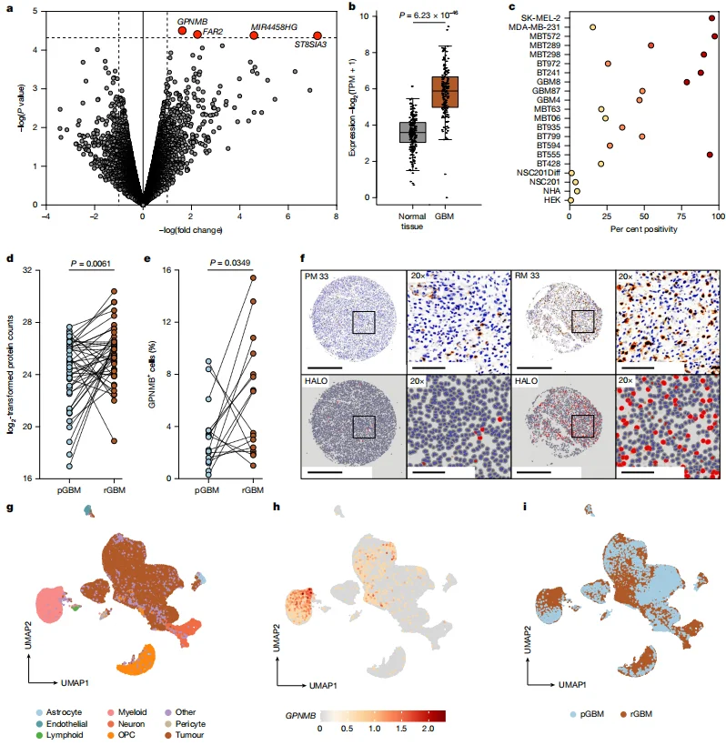 Figure 1. Identification of GPNMB as a clinically relevant target in GBM.