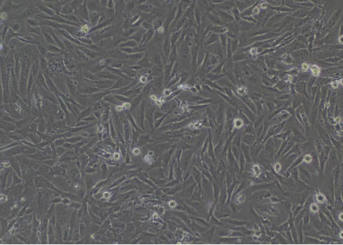 Lentiviral transduction cell image (bright-field)