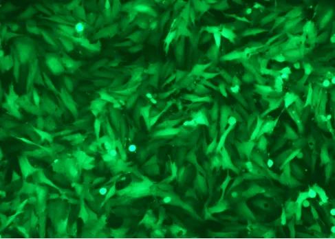 Lentiviral transduction cell image (fluorescence)