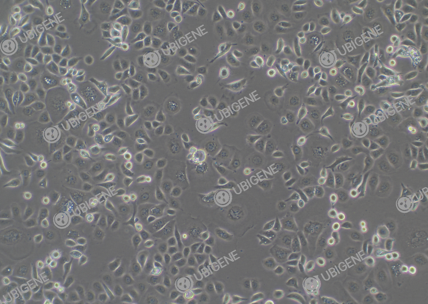 AGS cell line Cultured cell morphology