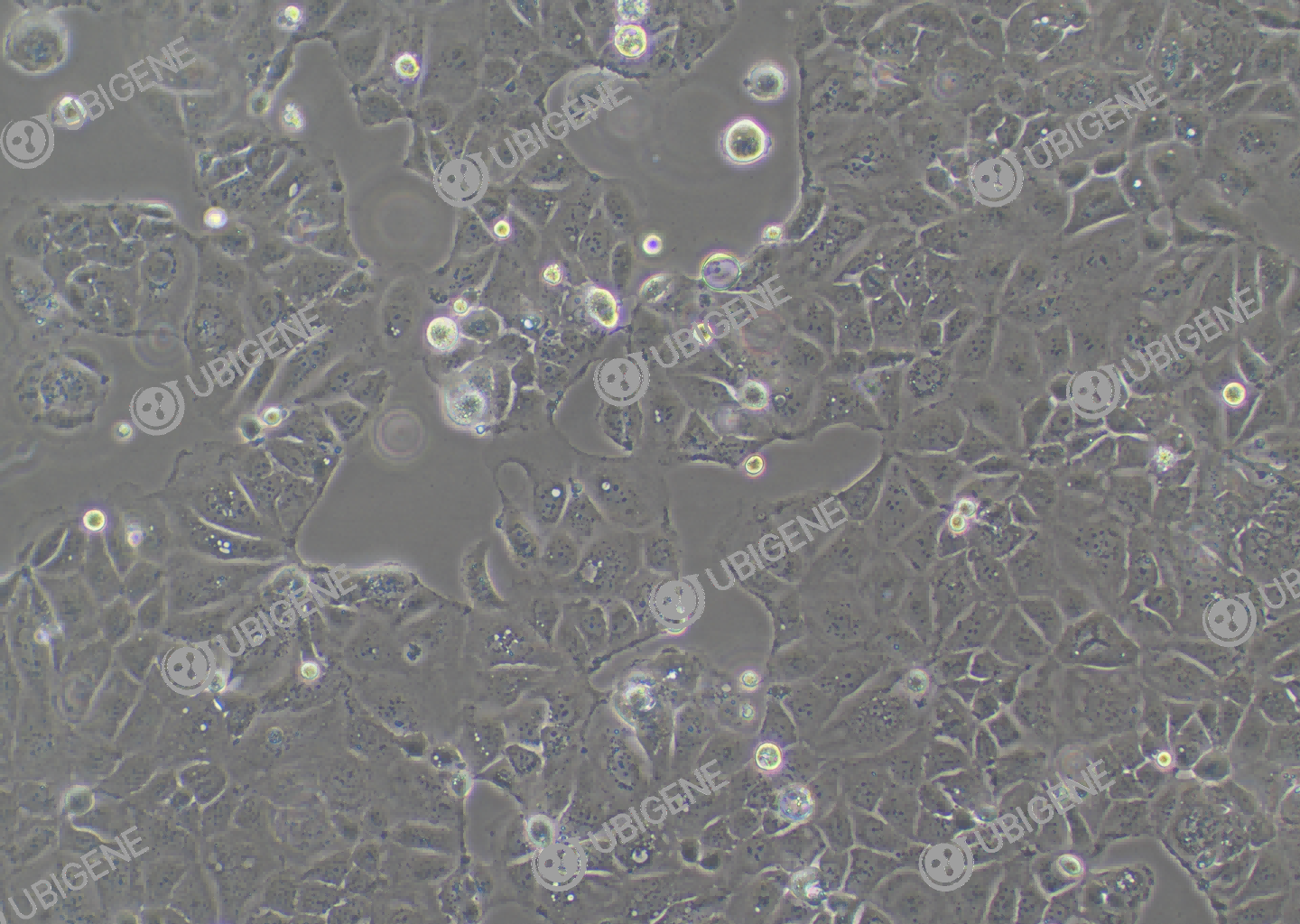 Caco-2 cell line Cultured cell morphology