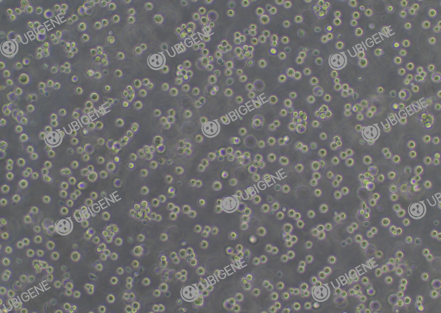 H22 cell line Cultured cell morphology