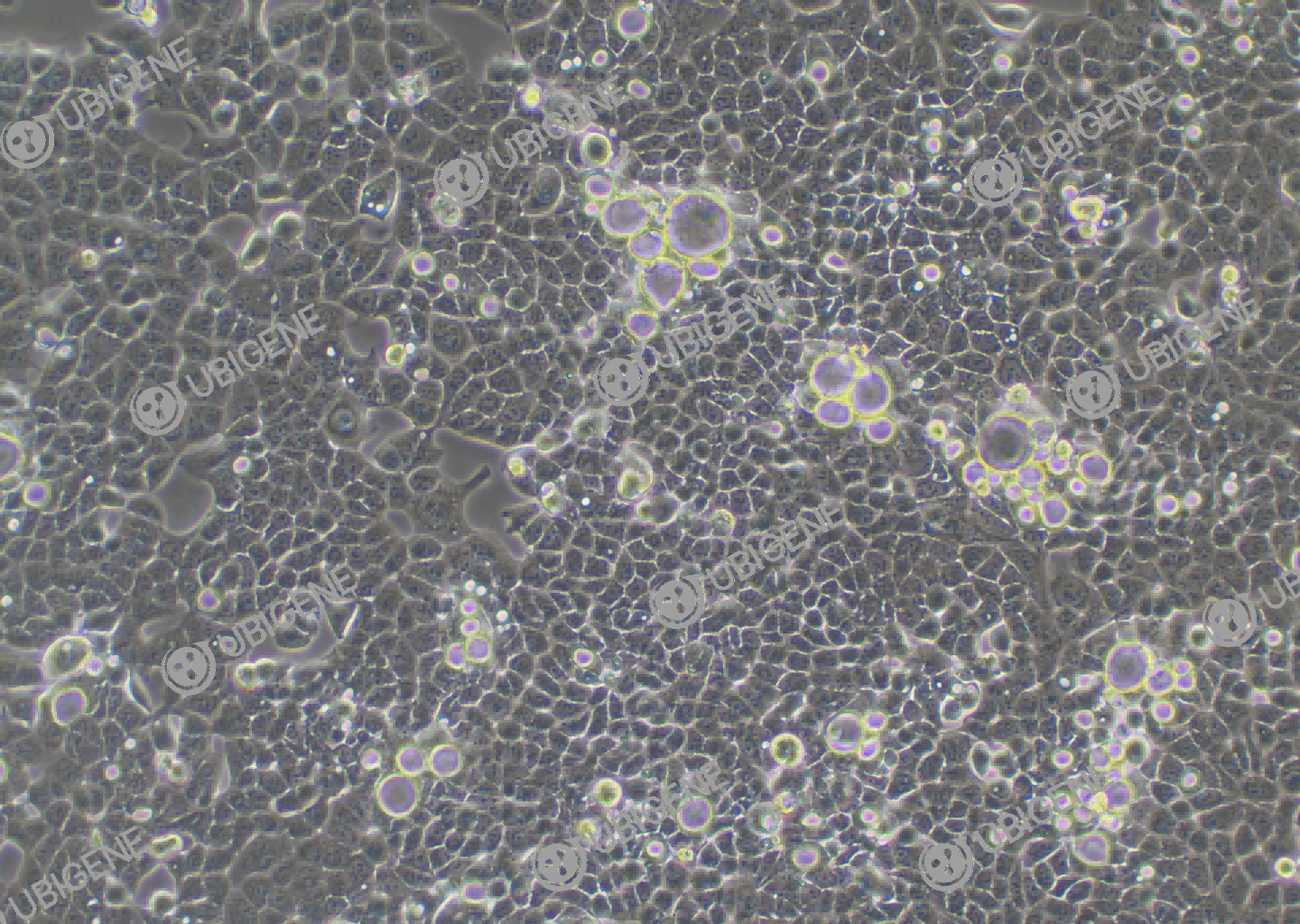 HEC-1-B cell line Cultured cell morphology