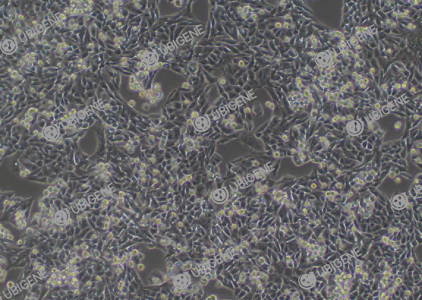 MB-49 cell line Cultured cell morphology