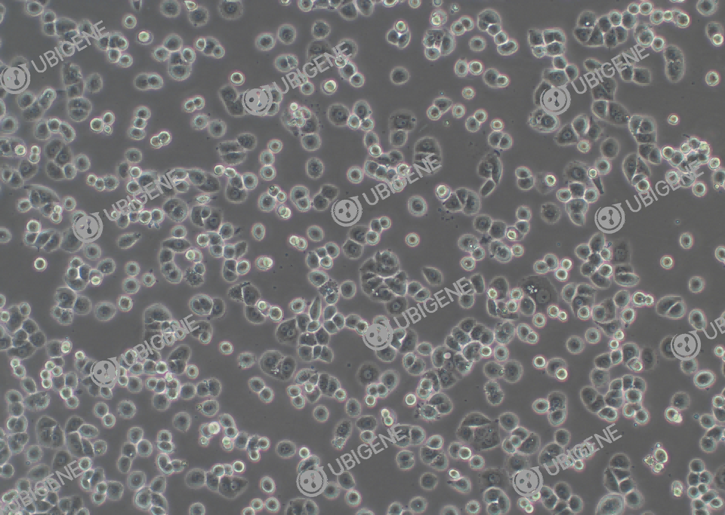 MDA-MB-468 cell line Cultured cell morphology