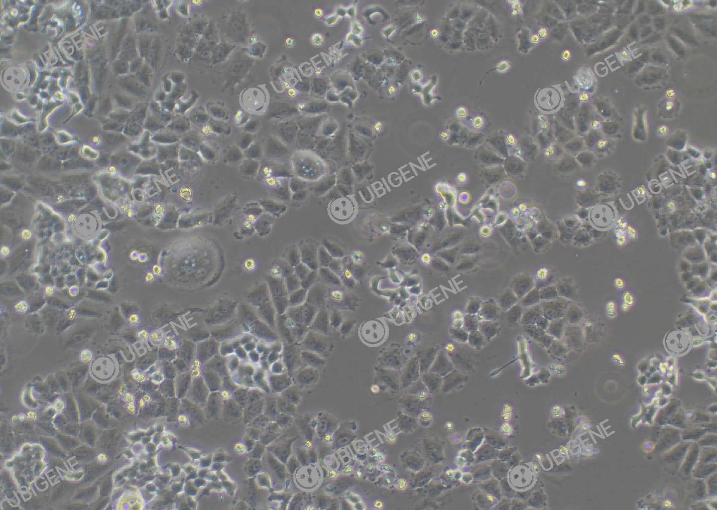 NCI-H727 cell line Cultured cell morphology