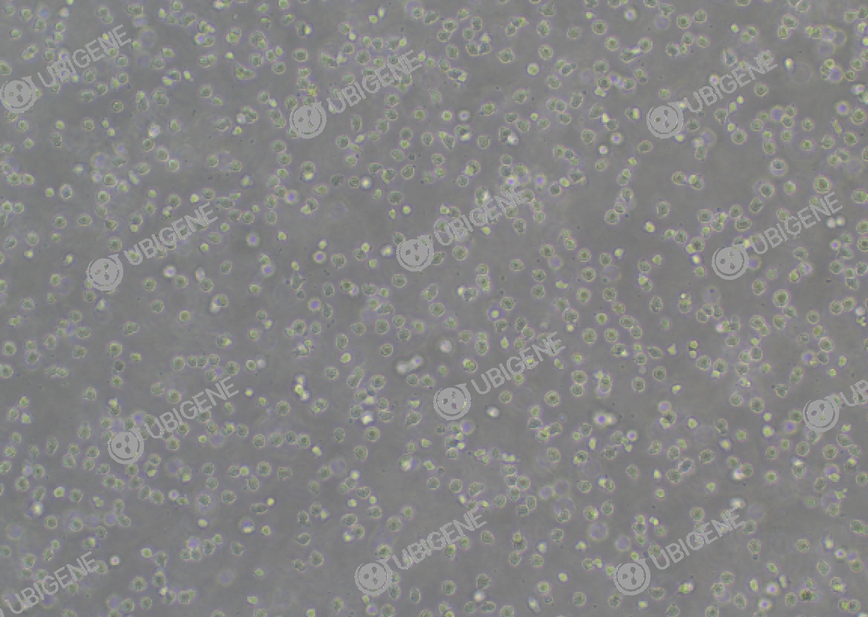 U-937 cell line Cultured cell morphology