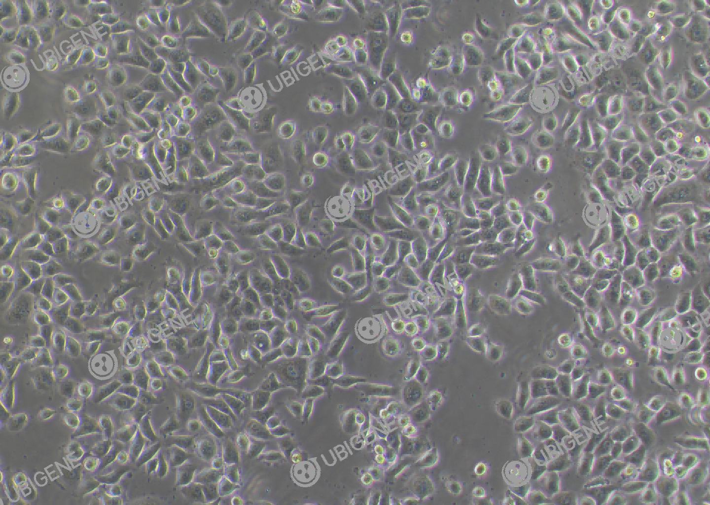 HK-1 cell line Cultured cell morphology