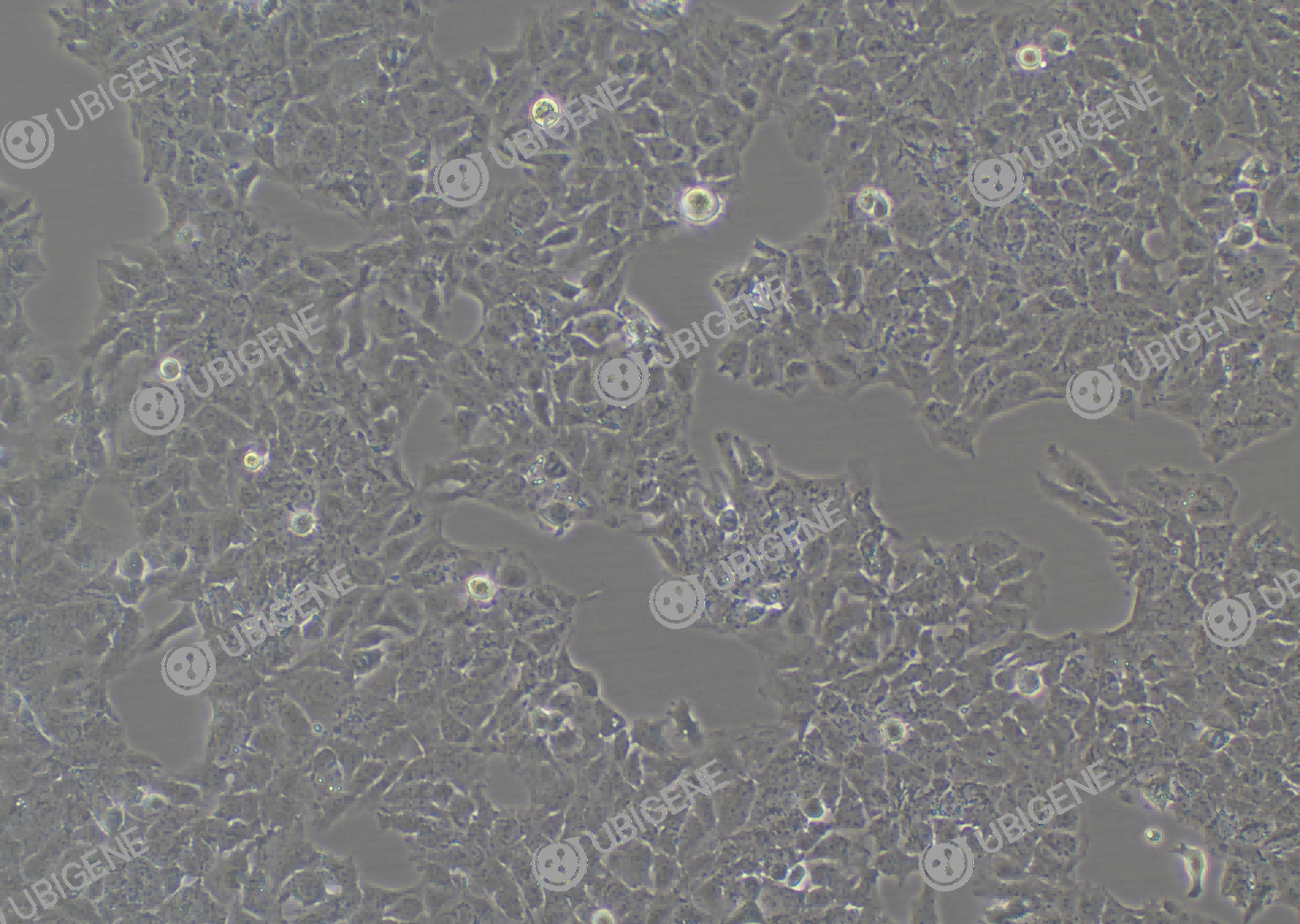 HuH-7 cell line Cultured cell morphology