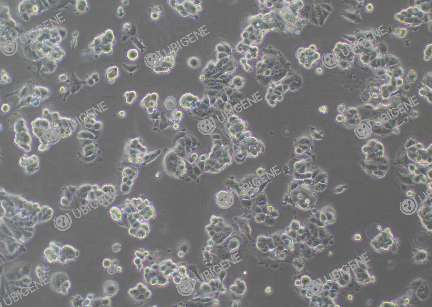 MCF7 cell line Cultured cell morphology