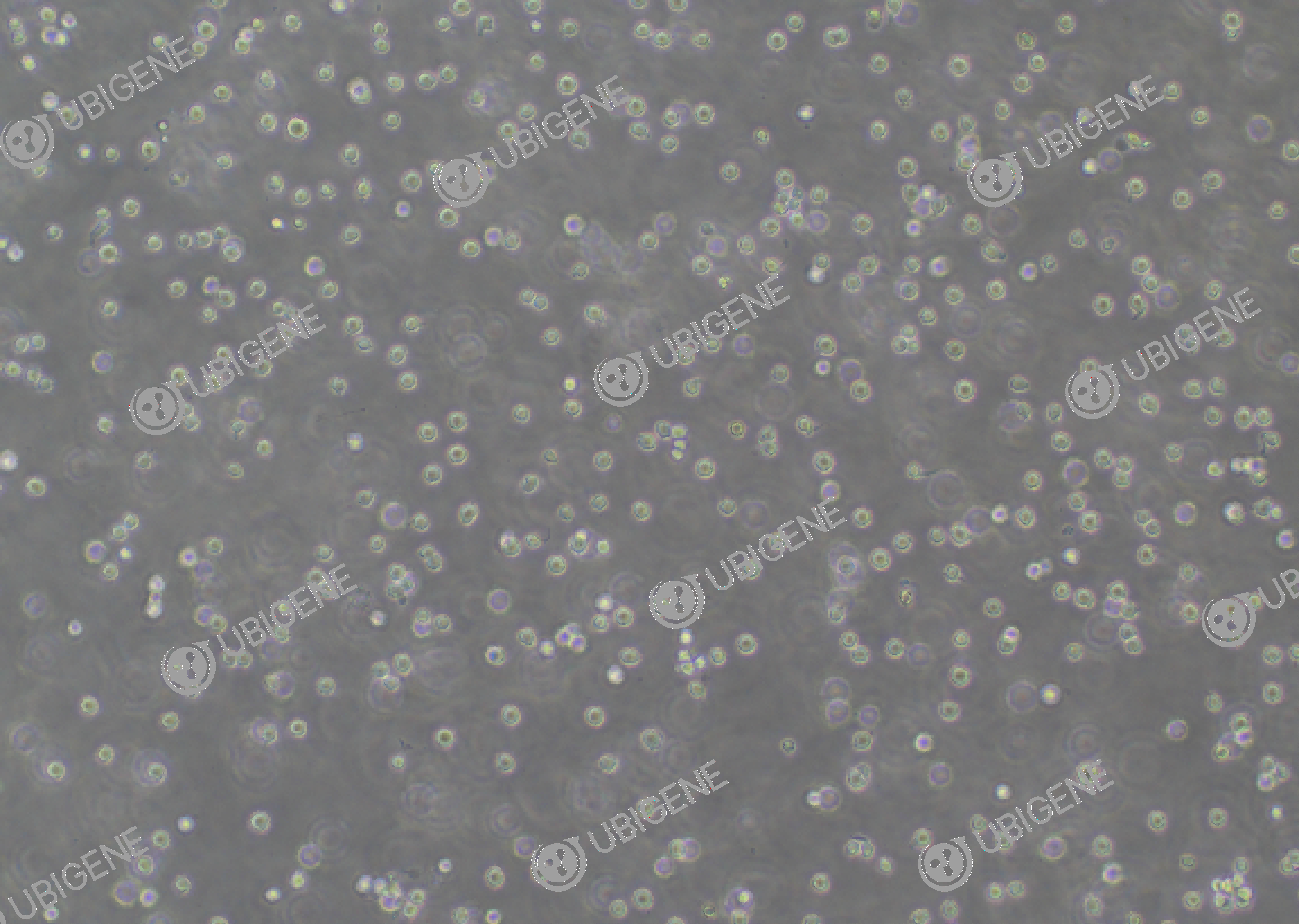 MV4-11 cell line Cultured cell morphology