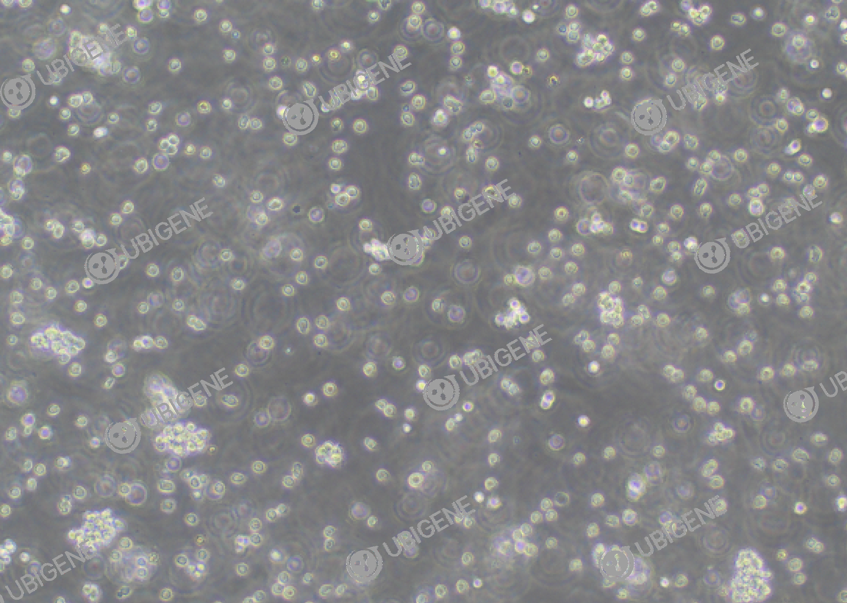U-2932 cell line Cultured cell morphology